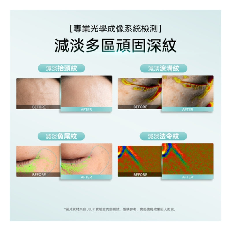 日本JUJY 小鯨玉極致煥發冰感膠原緊緻淡紋射頻儀 Pro 2.0